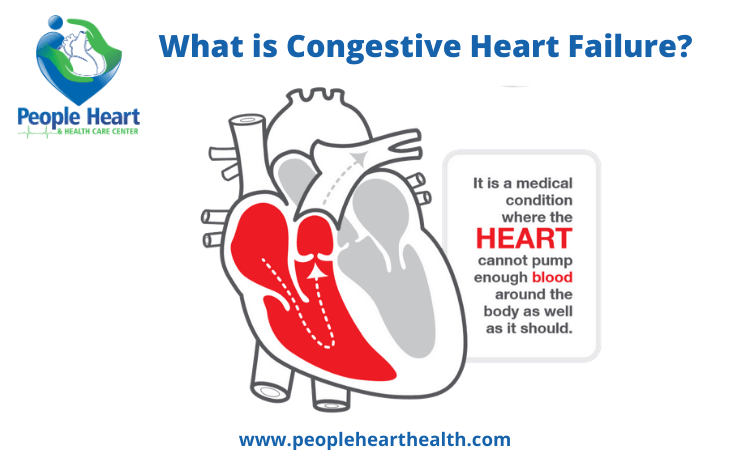congestive heart failure patient